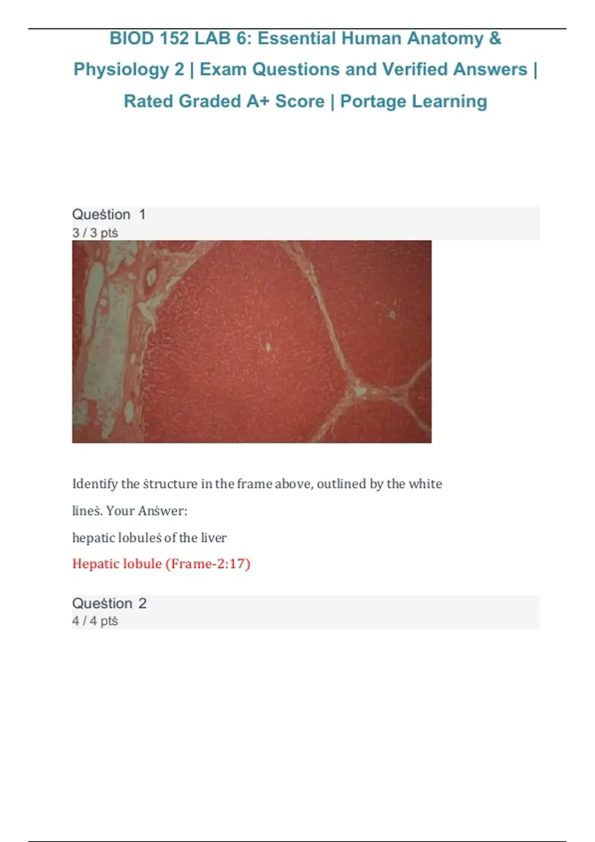 BIOD 152 Lab 6 – Essential Human Anatomy & Physiology II, Portage ...