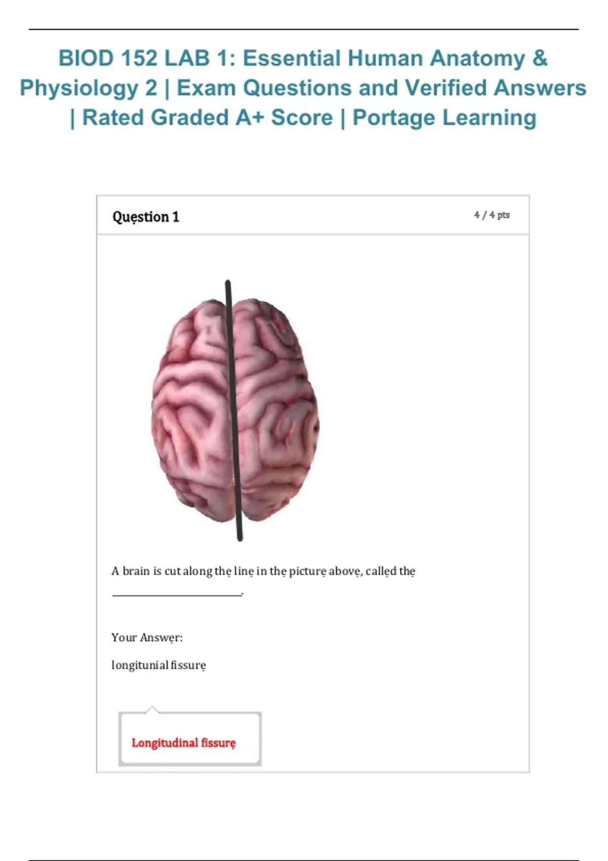 BIOD 152 Lab 1 – Essential Human Anatomy & Physiology II | Exam ...