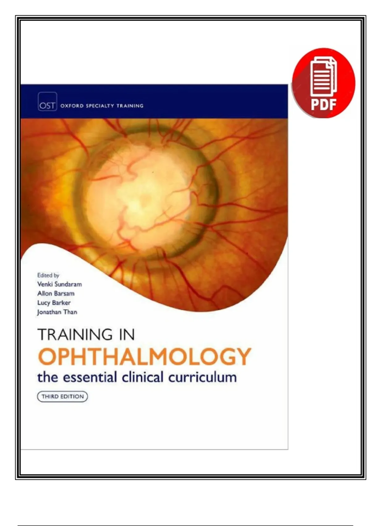 Training in Ophthalmology: The Essential Clinical Curriculum (3rd ...