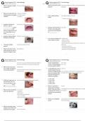 Dental Hygiene OSCE &ndash; Oral Pathology Stations & Examiner Checklists &sol; Score 100&percnt; &sol; New Version &sol; 2025 Update