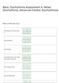 Basic Dysrhythmia Assessment A&comma; Relias Dysrhythmia&comma; Advanced Cardiac Dysrhythmias