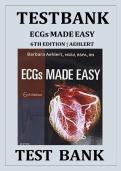 ECGs Made Easy Test Bank &ndash; 2025 Edition &ndash; Complete ECG Interpretation Practice Questions & Exam Prep