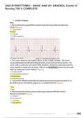 Relias Dysrhythmia Basic Testbank Answers 2025 &vert; A & B Graded Nursing Exams