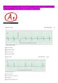 Relias Dysrhythmia Basic Test 35 Questions and Answers 2023 &lpar;Basic  A Dysrhythmia&rpar; GRADED A LATEST VERSION