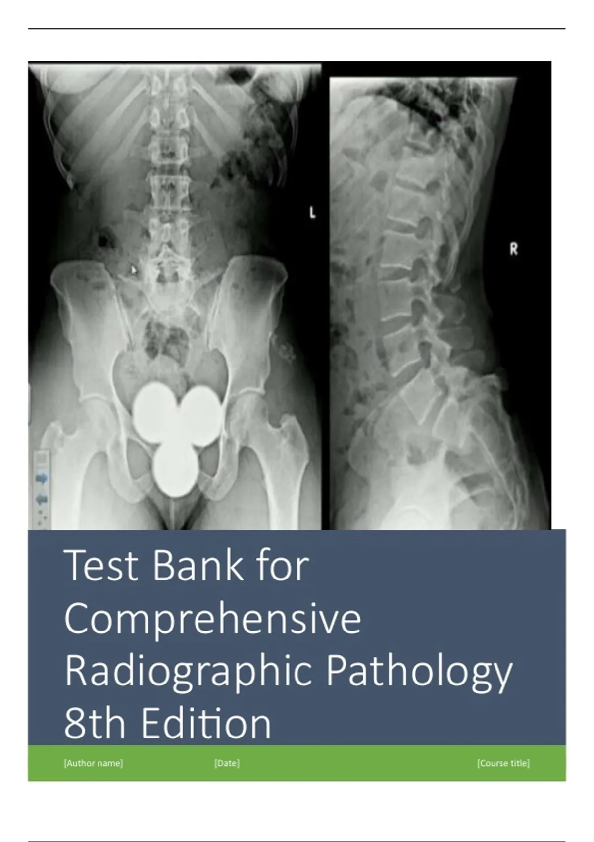 COMPREHENSIVE RADIOGRAPHIC PATHOLOGY 8TH EDITION TEST BANK – MULTIPLE ...