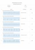 Complex Adult Health NR 341 ECG2 - Detailed Test Report for Steven Zheng Identifying Dysrhythmias Exam Date &lowbar; Time Result &vert; 2026 Latest Update &vert; Verified Solutions