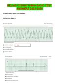 RELIAS DYSRHYTHMIA BASIC TEST DYSRHYTHMIA &ndash; BASIC A &lpar;A&plus; GRADED&rpar; ANSWERS 2025-2026