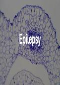 Introduction to Epilepsy &lpar;Types&comma; symptoms&comma; causes&comma;Treatment&comma;Diagnosis&comma; Medication&rpar;
