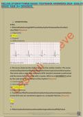 Relias Dysrhythmia&sol;RELIAS DYSRHYTHMIA BASIC TEST with all Questions and Answers &lpar;Updated Version&rpar; &lpar;Actual Exam from Recent Exam&rpar;