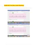 StaRN EKG Test &lpar;Non-Lethal Rhythms&rpar; 