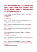 EKG National Exam 2026 EKG Tech National  Exam Latest Update 2026 Questions and  Correct Answers Rated A&plus; Questions and  Correct Answers Rated A&plus;