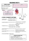 Complete EKG Interpretation Study Guide &ndash; All EKG Rhythms Covered &vert; ECG Analysis&comma; Practice Questions & Notes&period;