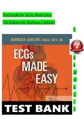 ECGs Made Easy&comma; 6th Edition Test Bank &ndash; Barbara Aehlert