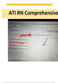 Final ATI RN Comprehensive Predictor Exit 2023&ndash;2026 Exam with NGN 180 Questions and Answers to Pass 2023&sol;2026 RN ATI Comprehensive Predictor Exit Exam with NGN 180 Questions and Rationales