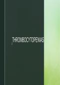   Thrombocytopenia                                  