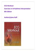 ECG Test Bank &vert; Arrhythmia Interpretation Practice &vert; ECG Workout 8th Edition &vert; 1500 NCLEX ECG Exam Prep Questions