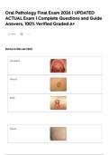 Oral Pathology Final Exam 2026 &vert; UPDATED ACTUAL Exam &vert; Complete Questions and Guide Answers&comma; 100&percnt; Verified Graded A&plus;