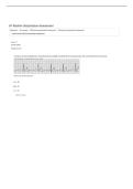 KP RHYTHM INTERPRETATION ASSESSMENT &vert; 50 QUESTIONS AND ANSWERS &vert; 2026 UPDATE &vert; WITH COMPLETE SOLUTIONS&period;