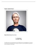 ISABELLA FISCHER SHADOW HEALTH-PRESSURE INJURY &vert; 2026 UPDATE &vert; WITH COMPLETE SOLUTIONS&period;