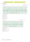 Relias Dysrhythmia Basic A Test &ndash; 2025&sol;2026 &ndash; Complete Questions and Correct Answers with Explanations&NewLine;