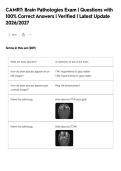 CAMRT&colon; Brain Pathologies Exam &vert; Questions with&NewLine;100&percnt; Correct Answers &vert; Verified &vert; Latest Update&NewLine;2026&sol;2027