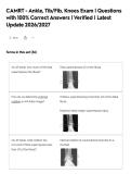 CAMRT - Ankle&comma; Tib&sol;Fib&comma; Knees Exam &vert; Questions&NewLine;with 100&percnt; Correct Answers &vert; Verified &vert; Latest&NewLine;Update 2026&sol;2027