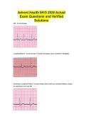 Advent Health EKG 2026 Actual Exam Questions and Verified Solutions