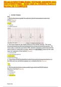 RELIAS DYSRHYTHMIA BASIC TESTBANK ANSWERS 2024-&NewLine;2026 DYSRHYTHMIA &ndash; BASIC A&B &lpar;A&plus; GRADED&rpar;&comma; Exams of&NewLine;Nursing 100 &percnt; COMPLETE
