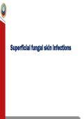 Fungal infections 