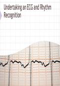  ECG AND RECOGNITION EXAM QUESTIONS WITH 100&percnt; COMPLETE ANSWERS&comma; 2026&sol;2027 ALREADY GRADED A&plus;