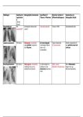 Ademhaling - Tabel Radiologie 