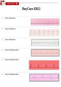 BayCare EKG Test Bank &lpar;2026&ndash;2027&rpar; &vert; Verified Questions & Correct Answers &vert; Nursing PDF