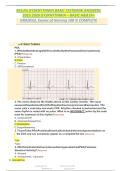 Relias Dysrhythmia Basic A & B Practice Questions with Verified Answers 2027&sol;2028