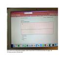 RN Relias Basic DYSRHYTHMIA Exam A