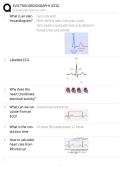Electrocardiography &lpar;ECG&rpar; EXAM STUDY GUIDE 2026&sol;2027 ACCURATE QUESTIONS WITH CORRECT DETAILED SOLUTIONS &vert;&vert; 100&percnt; GUARANTEED PASS NEWEST VERSION