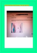 ATI MED SURG EXAM Retake &lpar;2023&rpar; 100 Questions&sol; ATI MED SURG EXAM RETAKE