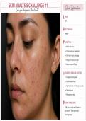 SKIN ANALYSIS CHALLENGE &num;1