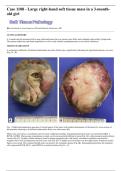 Case 1108&colon; Large Right-Hand Soft Tissue Mass in a 3-Month-Old Girl &vert; Pediatric Radiology Case Discussion & Study Guide