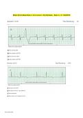 Relias Dysrhythmia Basic A Test Answers &vert; Cardiac Rhythm Study Guide & Exam Review 2026&sol;2027