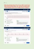 Relias Dysrhythmia Basic B Test Newest 2026 Actual Exam&vert; &NewLine;Basic B Dysrhythmia Relias Test with 60 &lpar;Screenshot&rpar; Real &NewLine;Exam Questions and Correct Verified Answer&sol; Graded A&plus; 