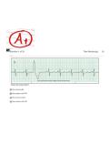 ECG rhythm interpretation quiz