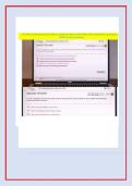 ATI PN COMPREHENSIVE PREDICTOR EXIT EXAM WITH NGN ALL 180 &NewLine;QUESTIONS AND 100&percnt; CORRECT ANSWERS TO PASS 2026 ACTUAL PN &NewLine;ATI COMPREHENSIVE PREDICTOR EXIT EXAM 