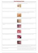 Oral Pathology Exam Questions & Answers 2026-2027 &vert; Dental Pathology Study Guide&comma; Practice Test & Exam Prep