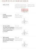 Nursing EKG Test &ndash; Abnormal Heart Rhythms Practice Questions&comma; Answers & Study Guide