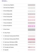 EKG Rhythms&NewLine;EKG Interpretation&NewLine;ECG Rhythm Practice&NewLine;Cardiac Rhythm Study Guide