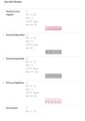 Sinus EKG Rhythms&NewLine;Sinus Rhythm Interpretation&NewLine;EKG Rhythm Practice&NewLine;Cardiac Rhythm Study Guide&NewLine;