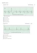Relias Dysrhythmia Basic A Exam&comma; Relias Dysrhythmia Exam Questions&comma; Dysrhythmia Basic A Study Guide&comma; Relias Exam Answers