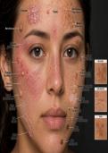 Hyper Realistic Image of all of the Diseases and Disorders of the face 