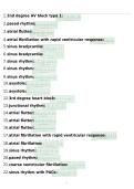Relias Basic Dysrhythmia Assessment A Exam &lpar;Latest 2026 &sol; 2027 Update&rpar; Questions and Verified Answers &vert; 100&percnt; Correct &vert; Grade A&plus;