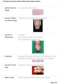 Nail Shape and Curvature Abnormalities &lbrack;2026&sol;2027&rsqb; &ndash; Complete Nursing Study Guide&comma; Questions & Answers